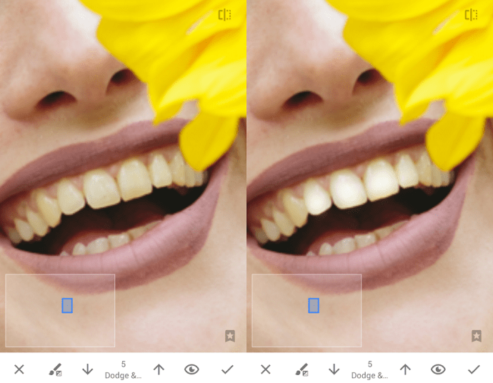 Bielenie zubov pomocou Snapseed